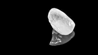 Faccette Dentali Estetiche