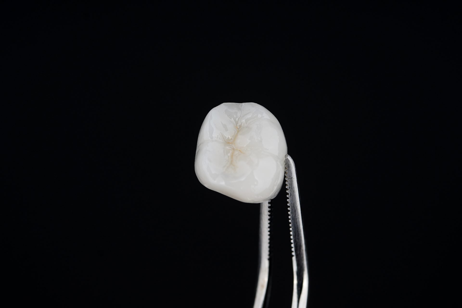 rialzo occlusale con ceramiche adesive